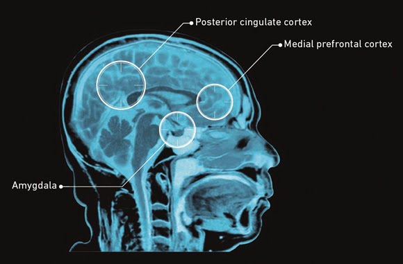 Why is Psilocybin Treatment Effective?